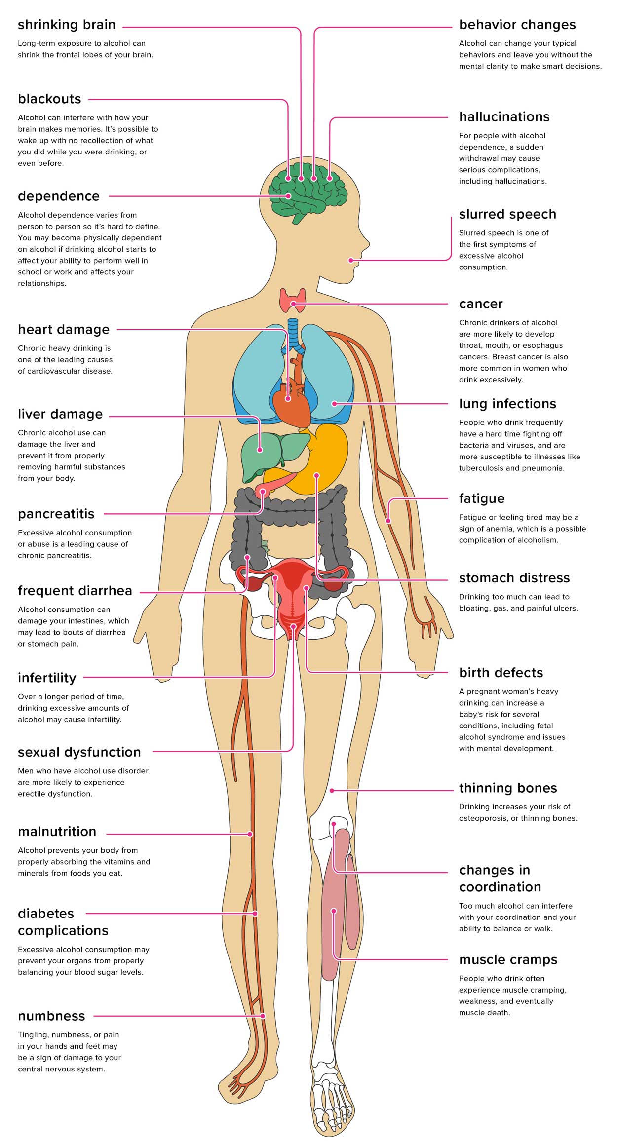 chart depicting the damage caused by excessive alcohol use to the body.